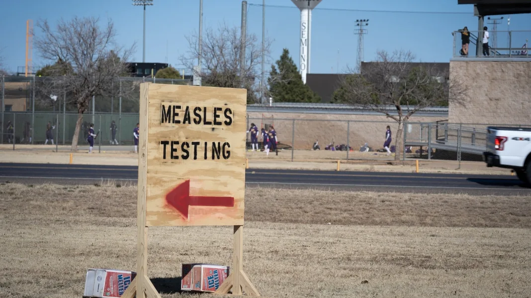 At least 171 measles cases confirmed in 9 states, CDC data shows
