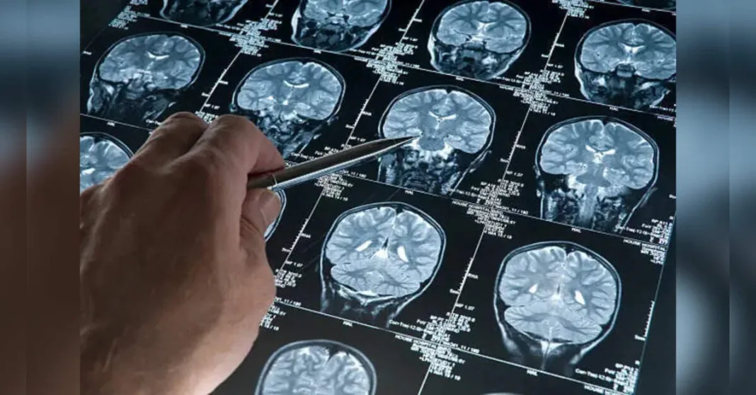 Ninefold Increase in Brain Aging Risk Linked to Environmental and Social Factors: Key Study, ETHealthworld