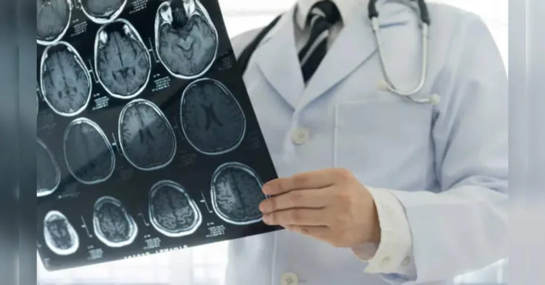 New Study Links White Matter Damage to Neurodegenerative Disease Features, ETHealthworld