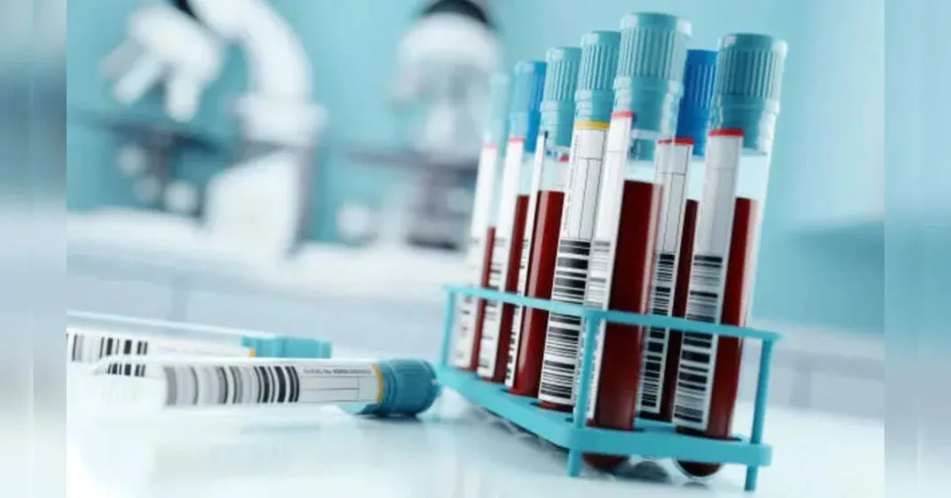 Revolutionary Blood Test Detects Alzheimer’s Signs Decades Early: Groundbreaking Study, ETHealthworld