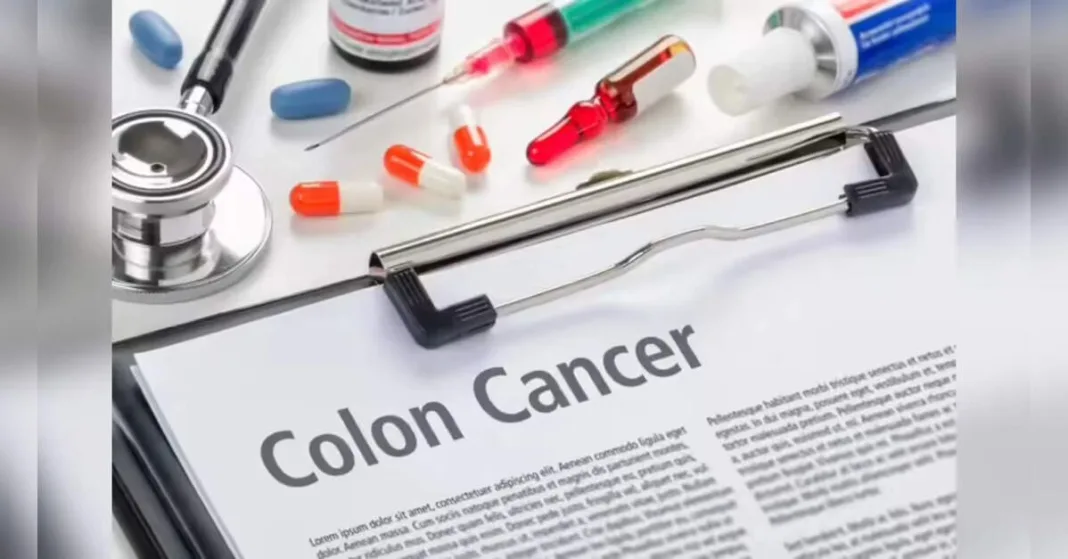 Revolutionary Blood Test Detects Pre-Cancerous Colorectal Lesions Early, ETHealthworld