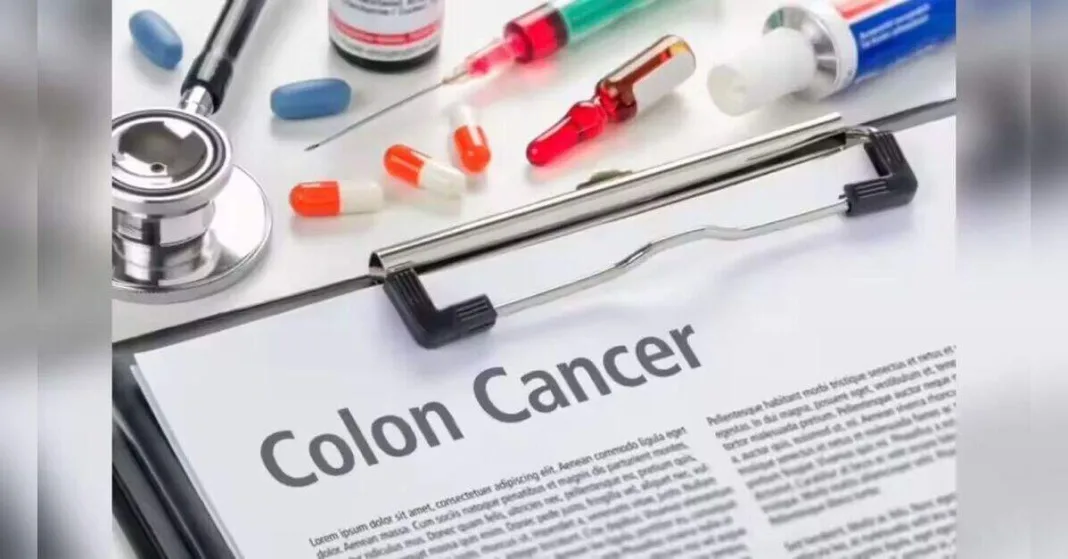 Appendix removal linked with lower colon cancer risk in study, ETHealthworld